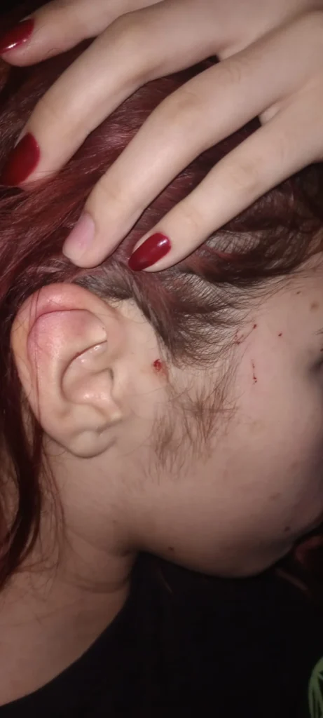 Atacaron a piedrazos un colectivo y una menor resultó herida